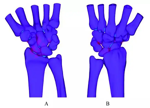 醫(yī)學(xué)有限元分析 - 副本.png