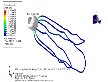 上海某某醫(yī)療科技股份有限公司封堵器力學(xué)性能有限元分析